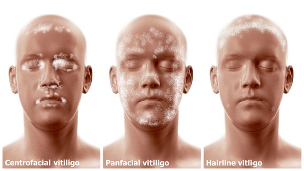 39d5f45aaba61b96269ec2b1bef3a28f 1762508673 1053 39d5f45aaba61b96269ec2b1bef3a28f 1762508673 1053