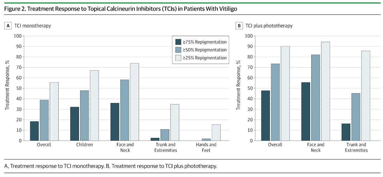 칼시뉴린 억제제 사용 후 어린이 얼굴 백반증에서 큰 호전을 보였다는 실험결과